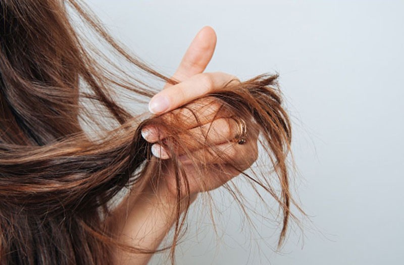 Dùng phấn rôm cho tóc có hại không?- Ảnh 2.