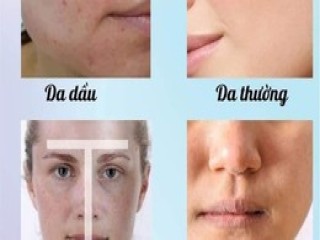 5 bước chăm sóc da cơ bản giúp da hết nhăn nheo