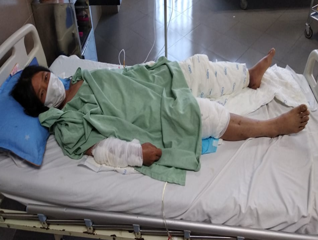 San sẻ yêu thương với những bệnh nhân bị bỏng nặng